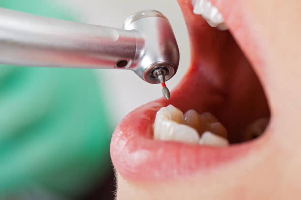 Best Emergency Gum Treatment in Shoreacres, TX